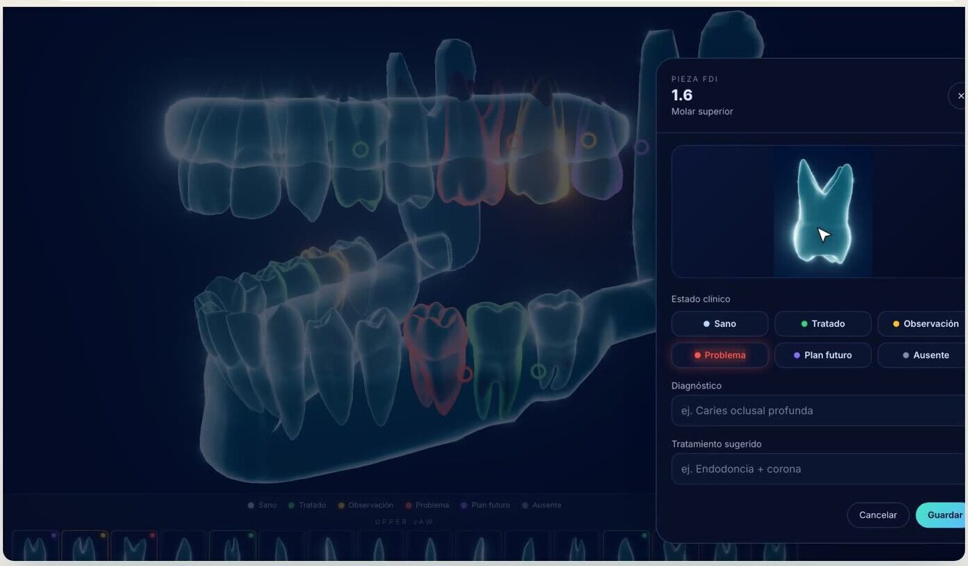 Detalle de pieza dental con diagnóstico y tratamiento en el odontograma de Sonrín